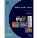 Plaies De La Main - T Dubert , E Masmejean