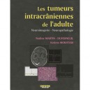 Les Tumeurs Intracraniennes De L Adulte - Martin Duverneu