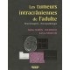 Les Tumeurs Intracraniennes De L Adulte - Martin Duverneu