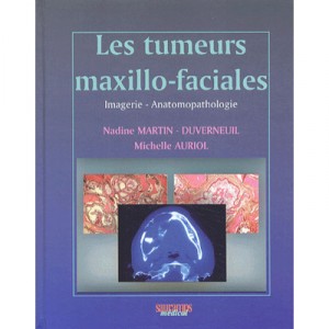 Les Tumeurs Maxillo-faciales , Imagerie, Anatomopathologie - Nadine Martin-duverneuil , Michelle Auriol