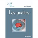 Les Uveites - Antoine Brezin