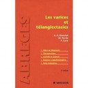 Les Varices Et Telangiectasies (2e Edition) - Albert-adrien Ramelet , M Perrin , P Kern