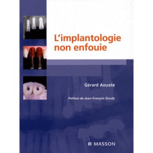 Implantology Not Buried - Gerard Aouate