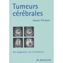 Tumeurs Cerebrales , Du Diagnostic Au Traitement - Jacques Philippon