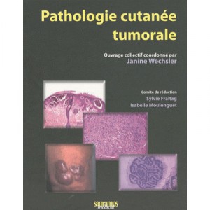 Tumor skin diseases - Janine Wechsler