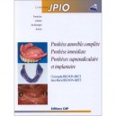 Prothese Amovible Complete Prothese Immediate Protheses Supra-radiculaire Et Implantaire - Rignon-bret Jm